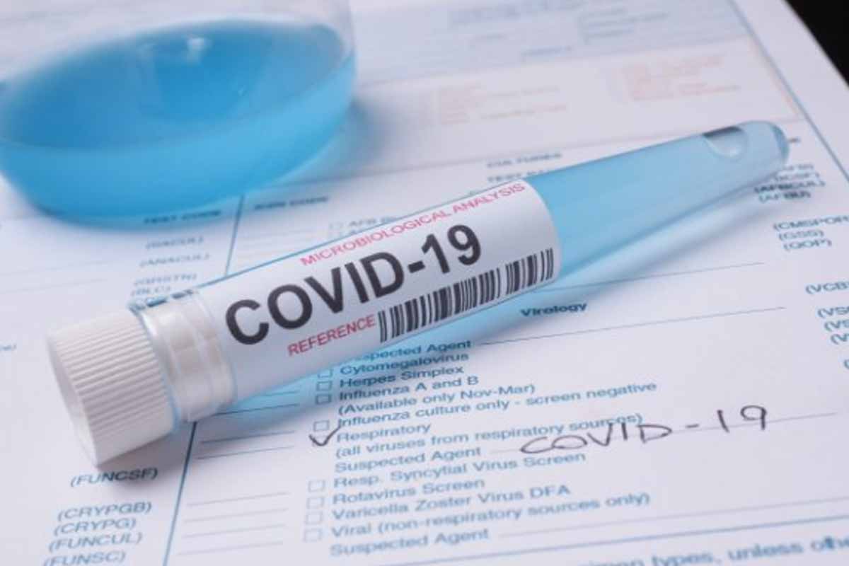 PepsiCo India funded COVID-19 testing kits start reaching laboratories